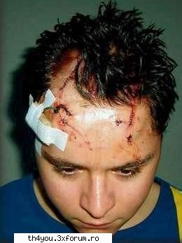 Tobosarul Tokio Hotel, dus de urgenta la spital - stiu ca stirea e mai veche - ●GusTaV SchAfEr●